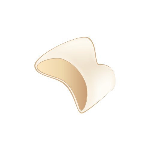 オールセラミック