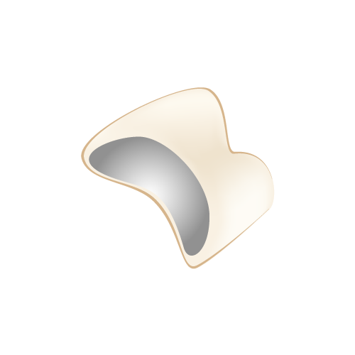 メタルセラミック